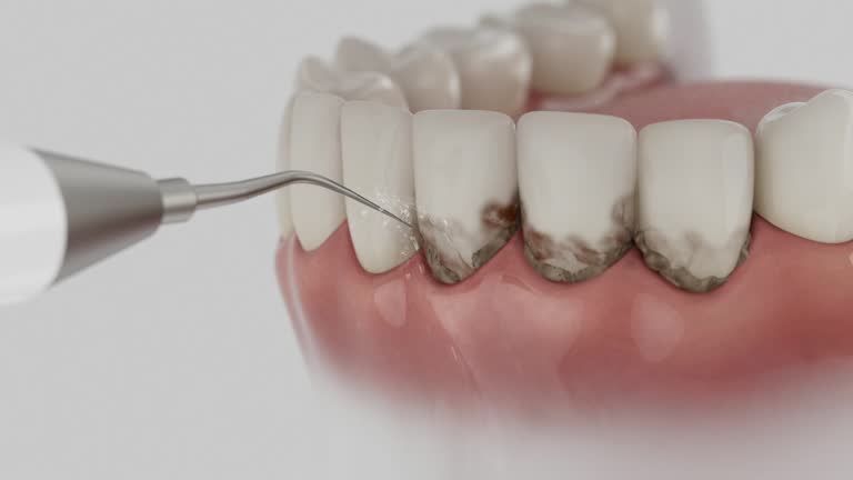 Trusted Teeth Cleaning And Checkup service in Floris, VA - Dentist Open Now